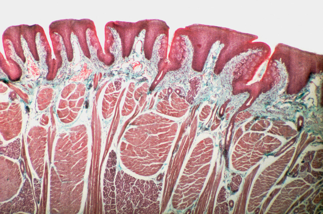 Light micrograph of the human tongue