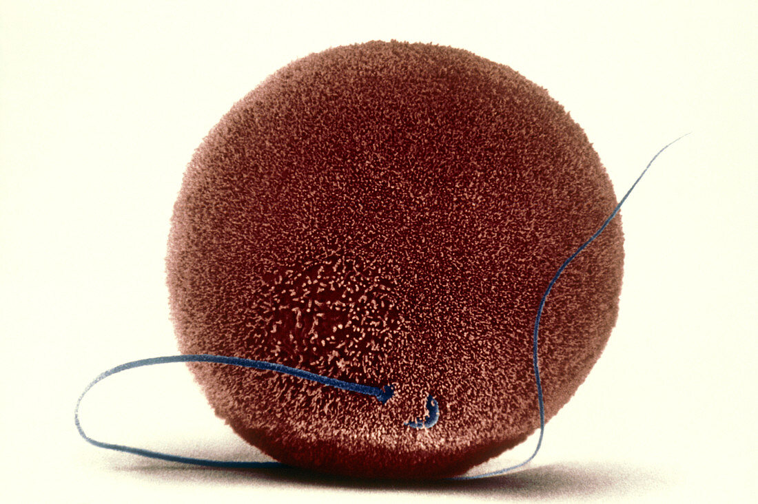 Coloured SEM of a human sperm fertilising an egg