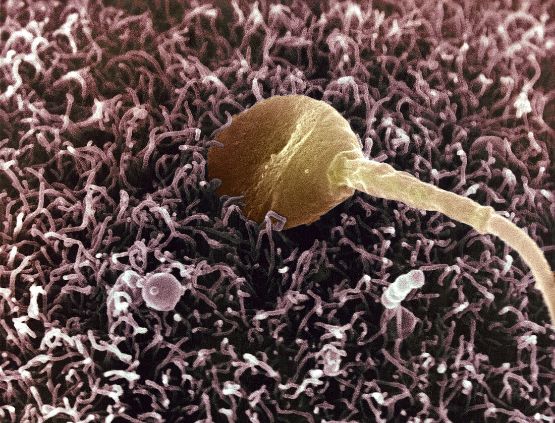 Human Spermatozoa Fertilizing an Egg