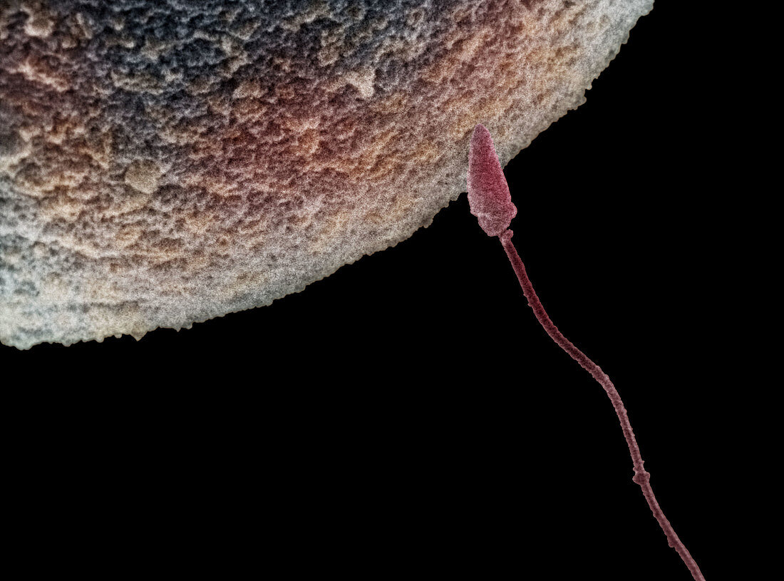 Single Sperm Penetrating an Egg