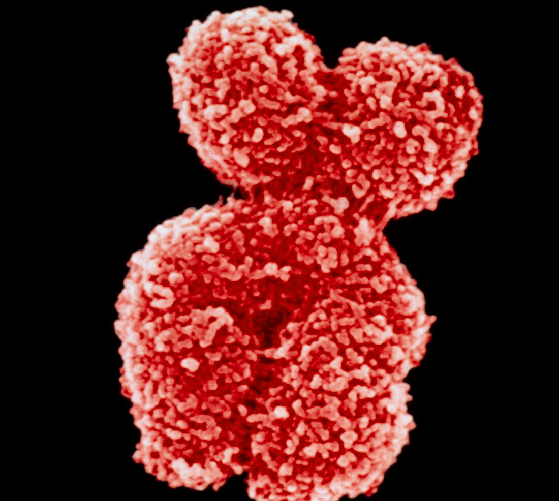 Coloured SEM of a human chromosome