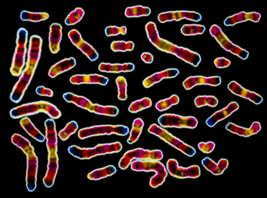 Human chromosomes