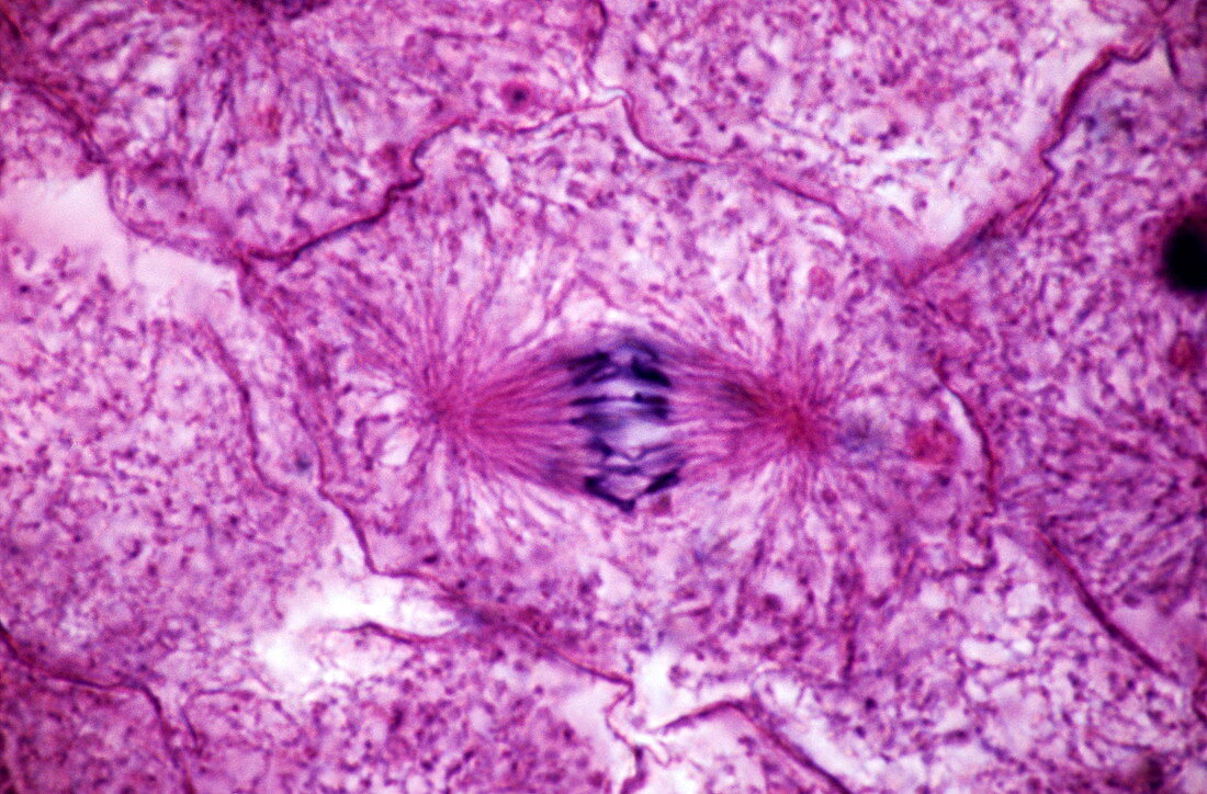 Early anaphase of mitosis,LM