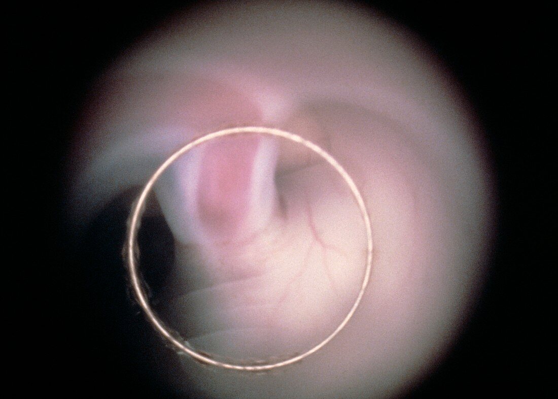Human foetus: umbilical cord