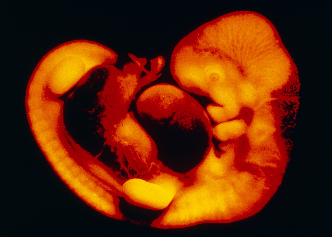 Human embryo at 30 days