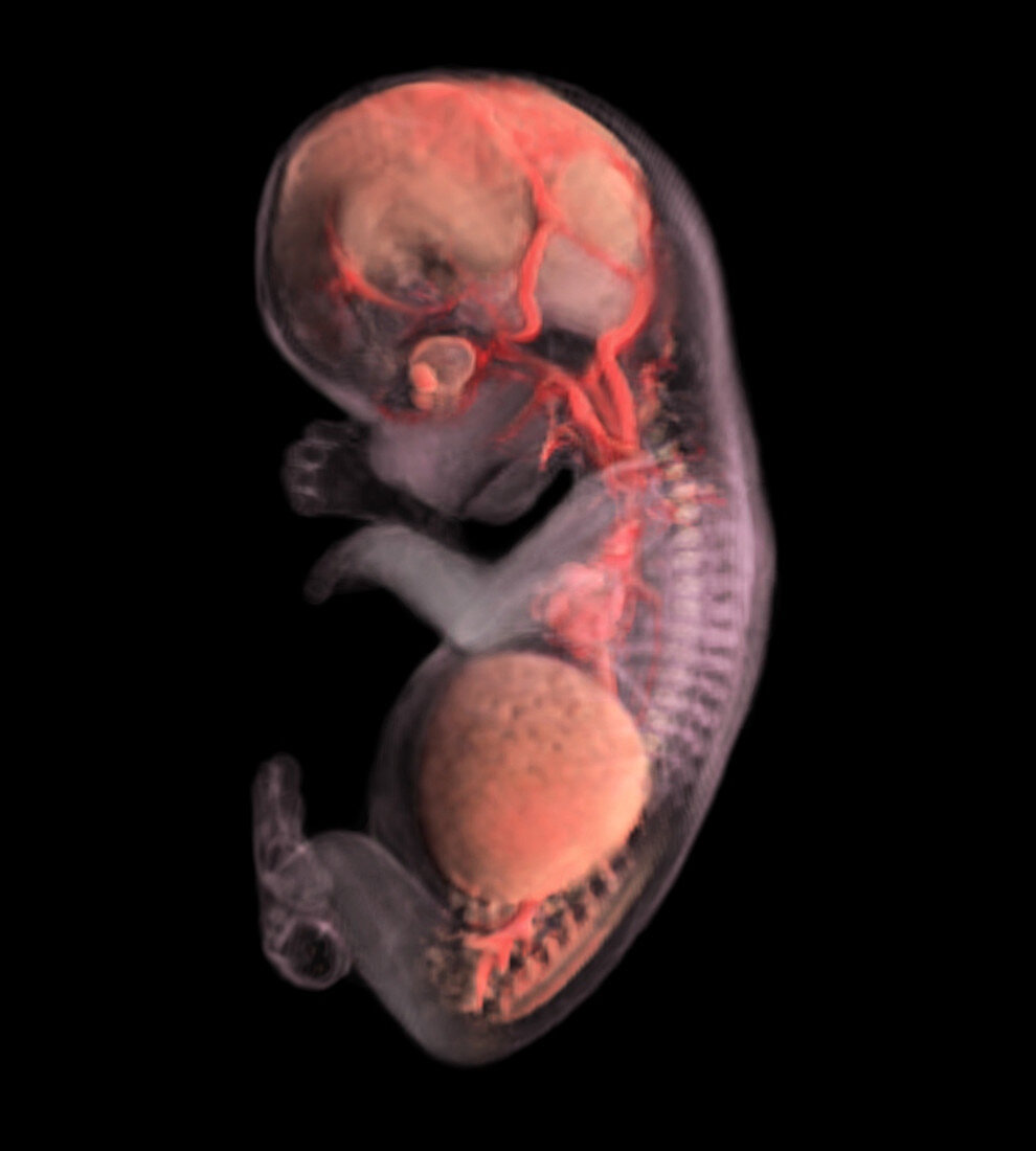 56-day-old Embryo (Micro-MRI)