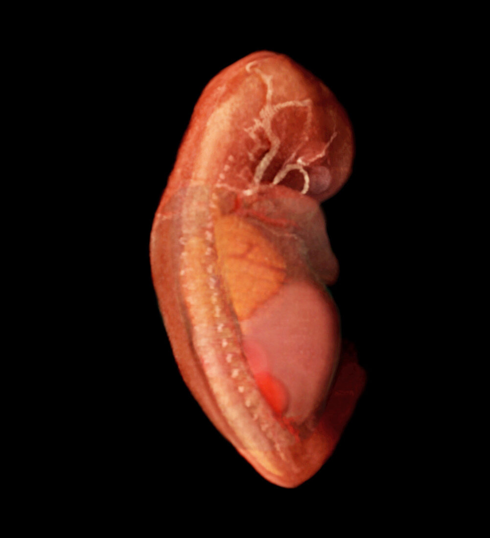 8 week embryonic Urinary System