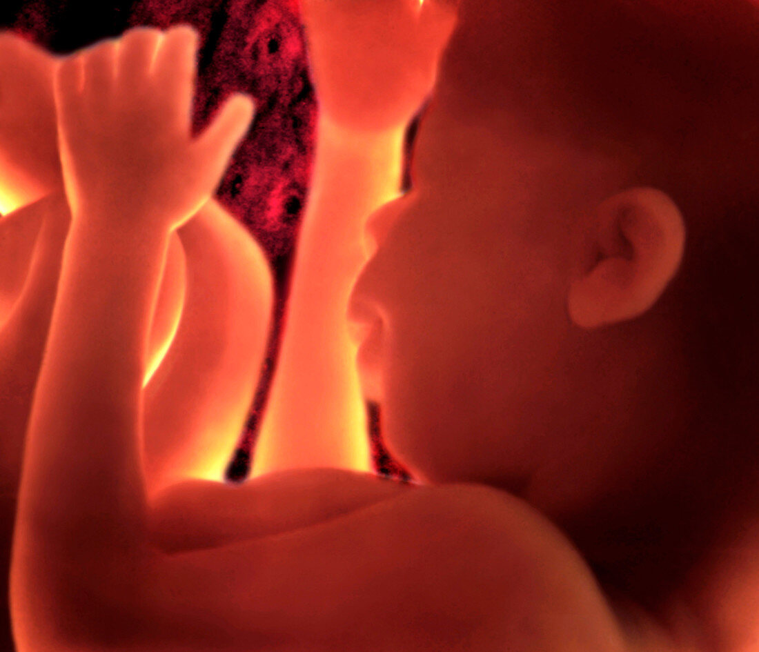 'Left-Sided View of foetus,8 Months'