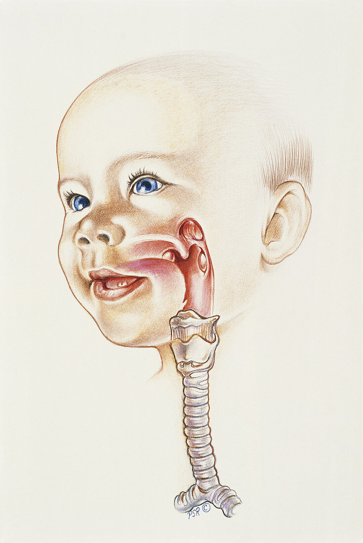 Trachea of a child