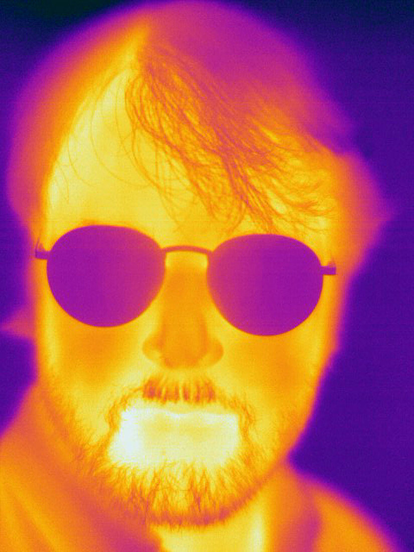Thermogram of a Man