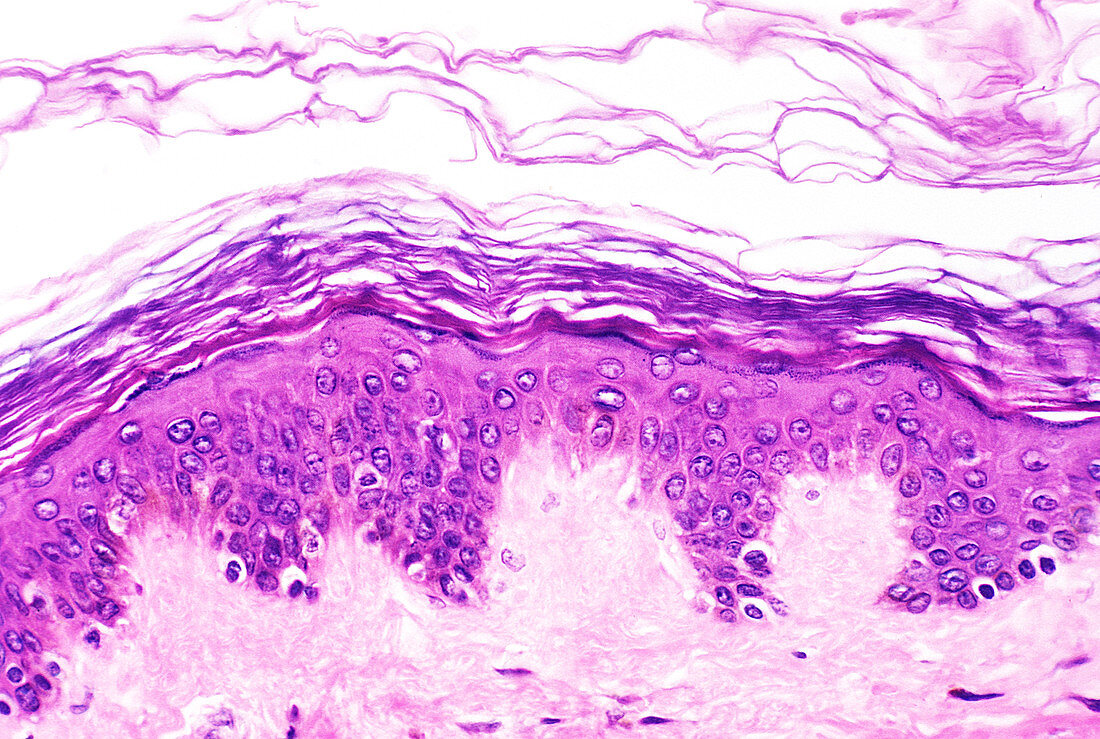 Human skin cross section