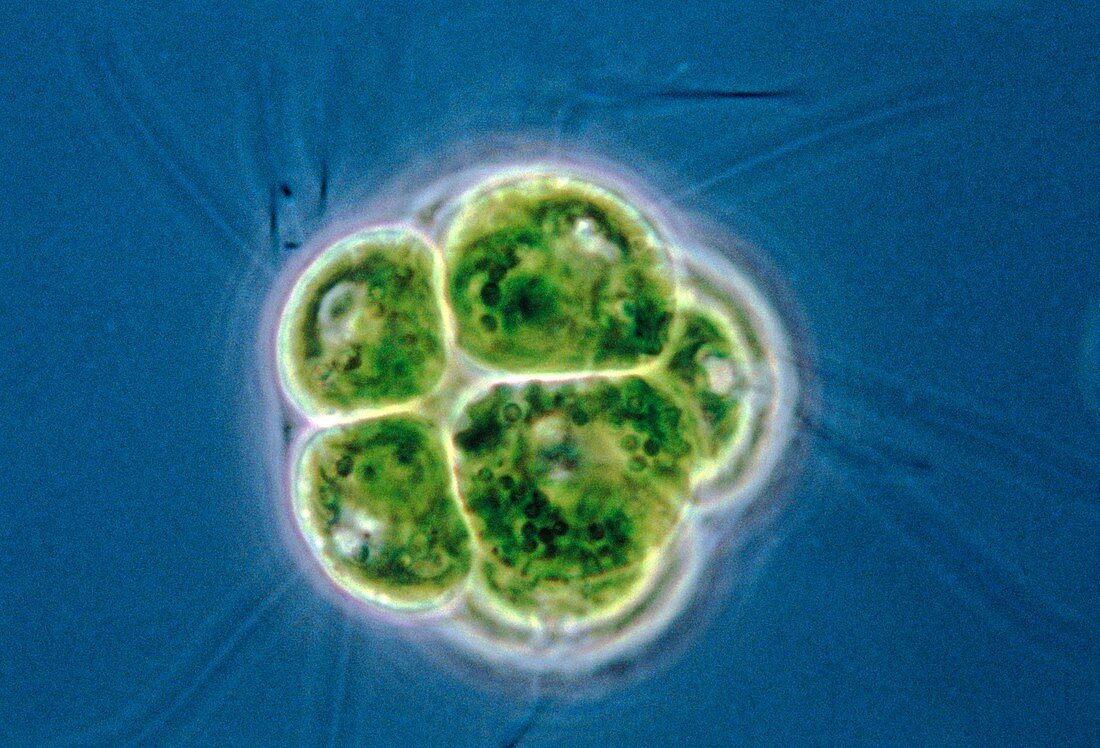LM of cells of freshwater flagellate,Pandorina