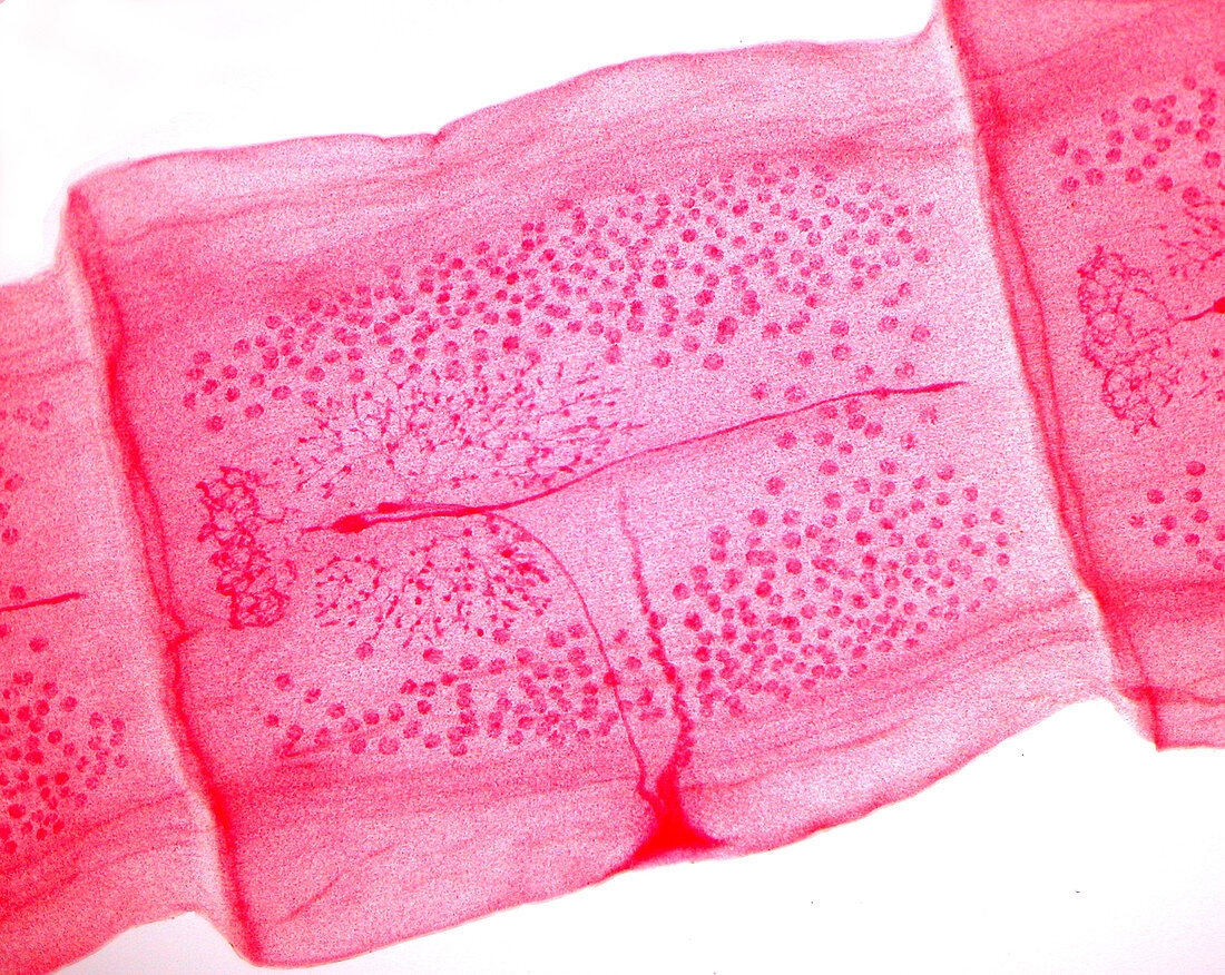 Tapeworm Reproductive Segment