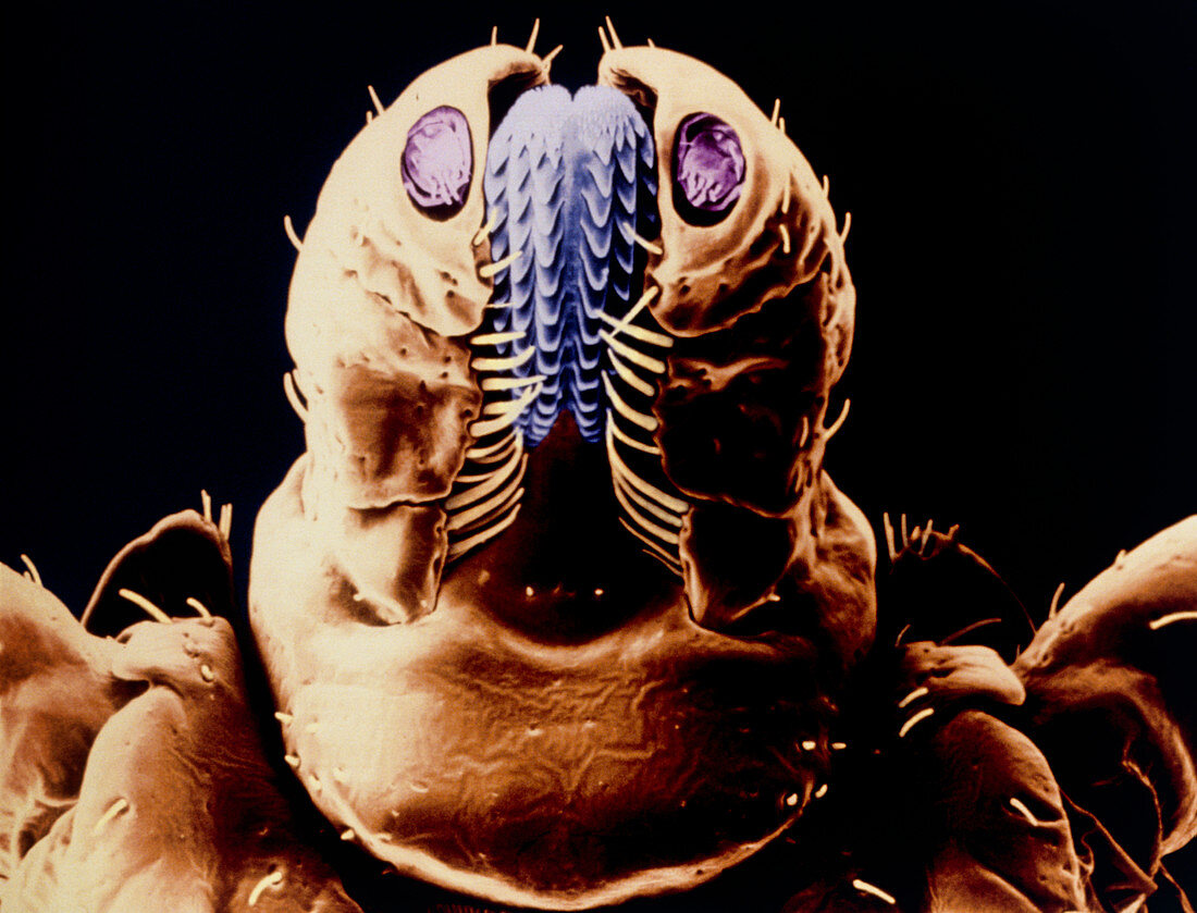 Coloured SEM of the mouthparts of a dog tick