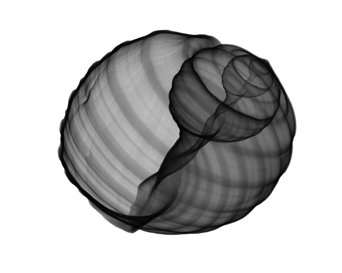 X-ray of Tun Shell