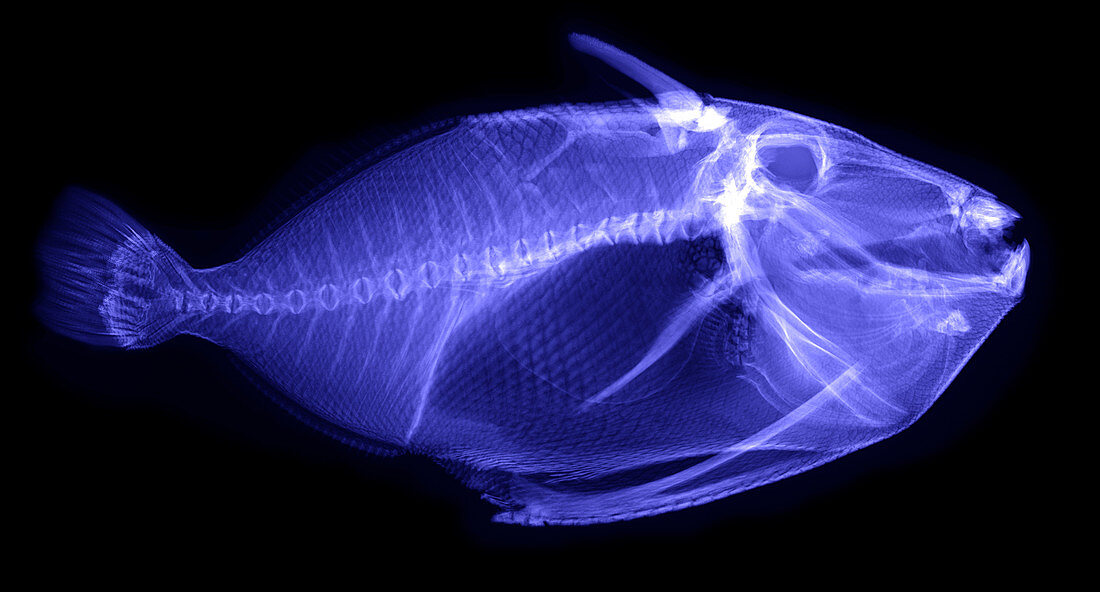 X-ray of a Clown Triggerfish