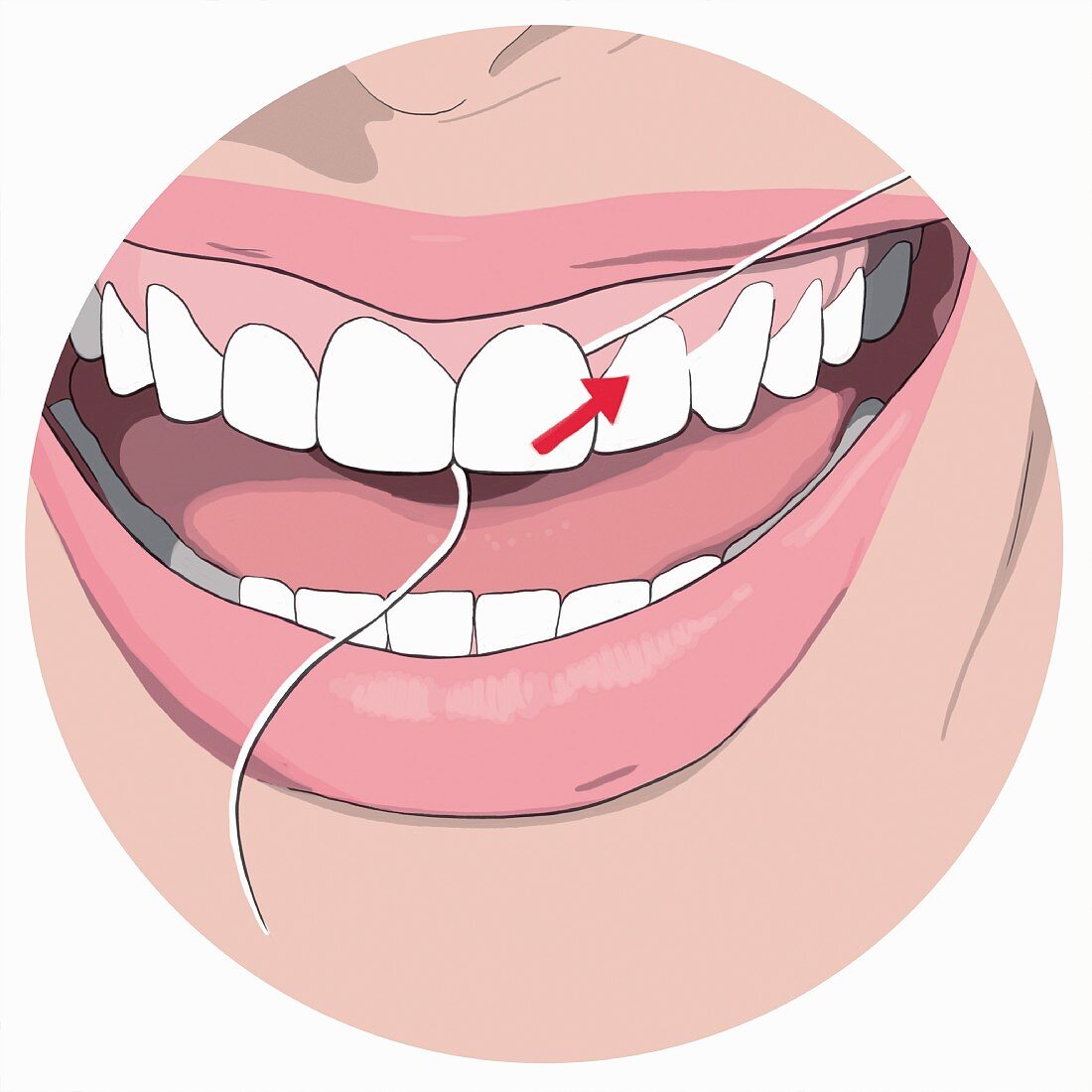 Zahnseide benutzen, Schritt 4: Innere Seite des Fadens loslassen und nach außen ziehen