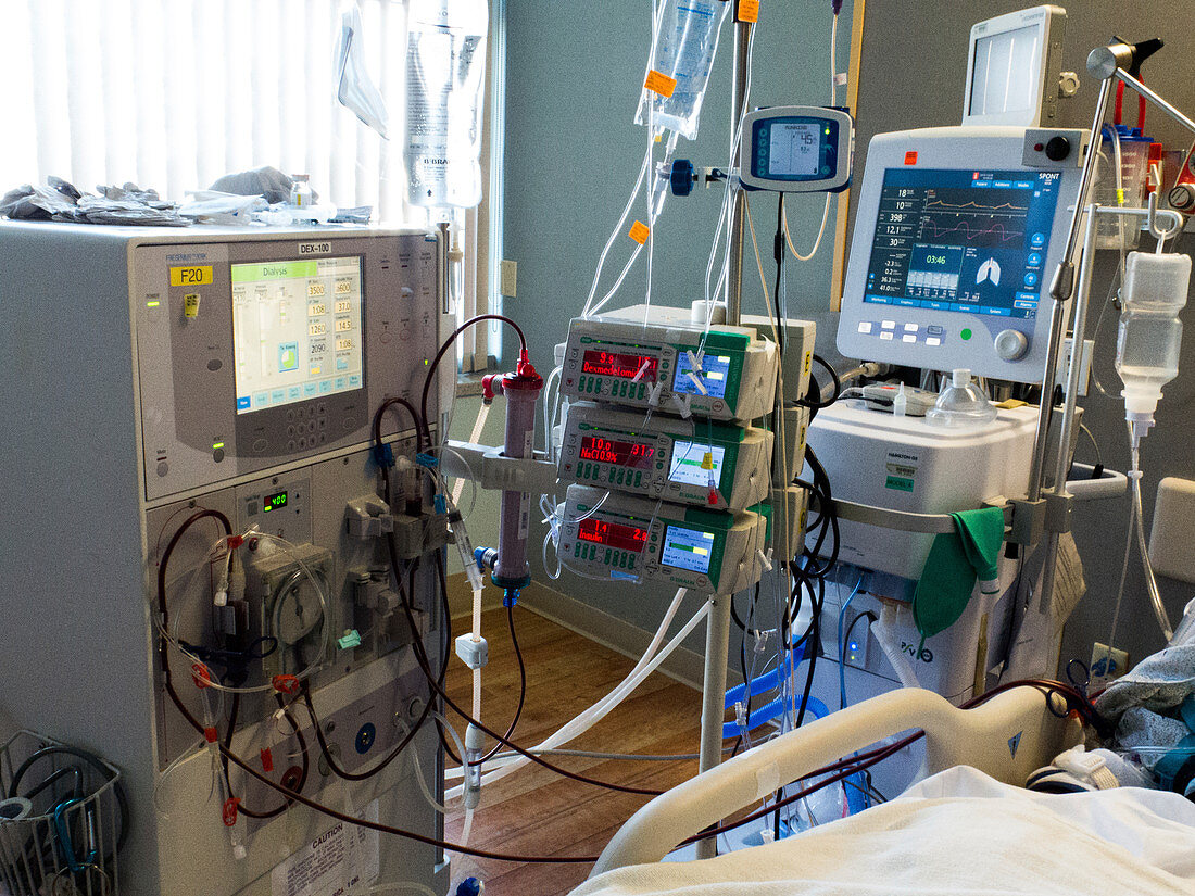 Kidney dialysis in intensive care unit
