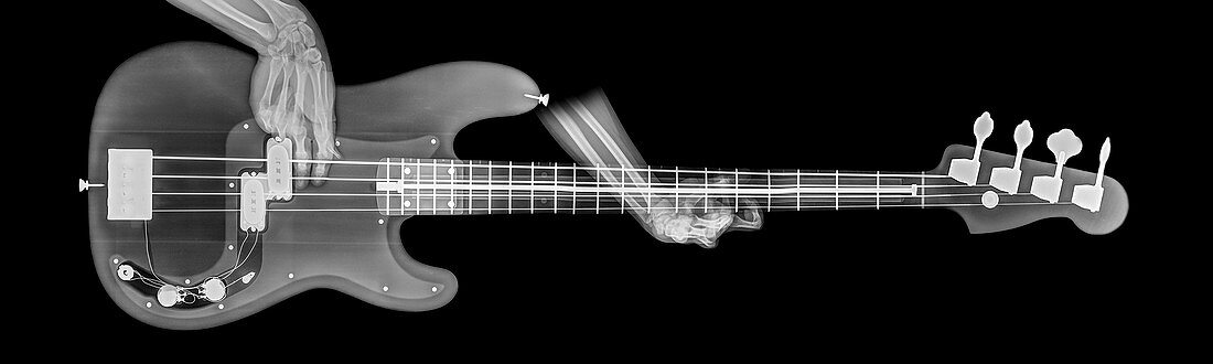 Bass Guitar under x-ray