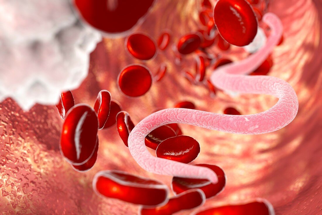 Microfilaria worms in blood,illustration