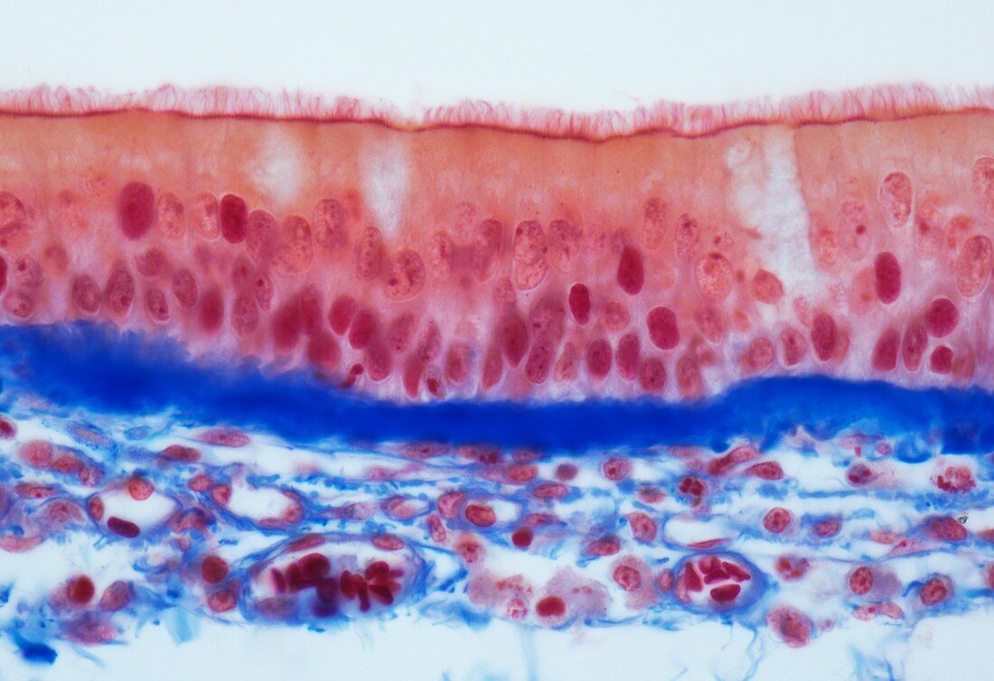 Tracheal epithelium,LM