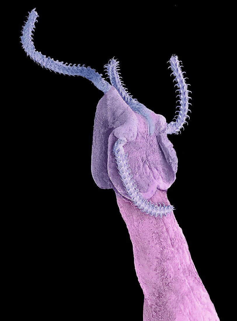 Grillotia tapeworm,SEM