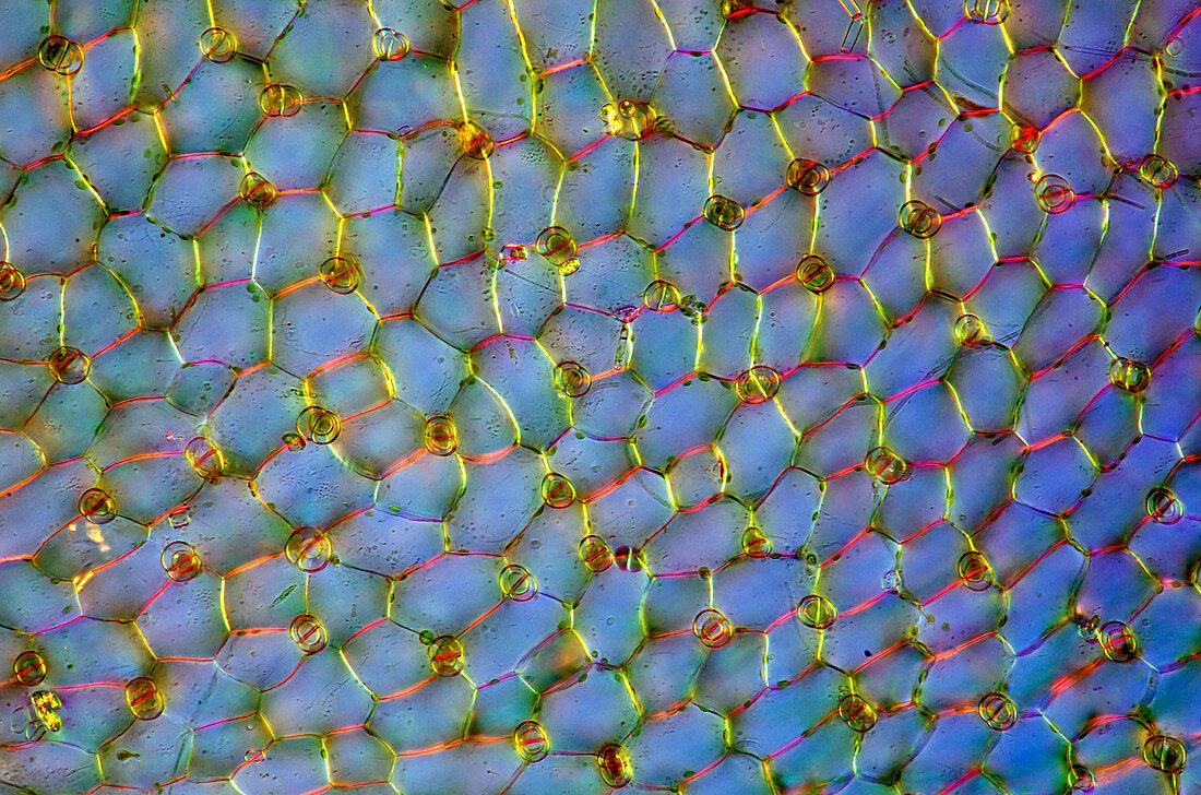Bladderwort,light micrograph