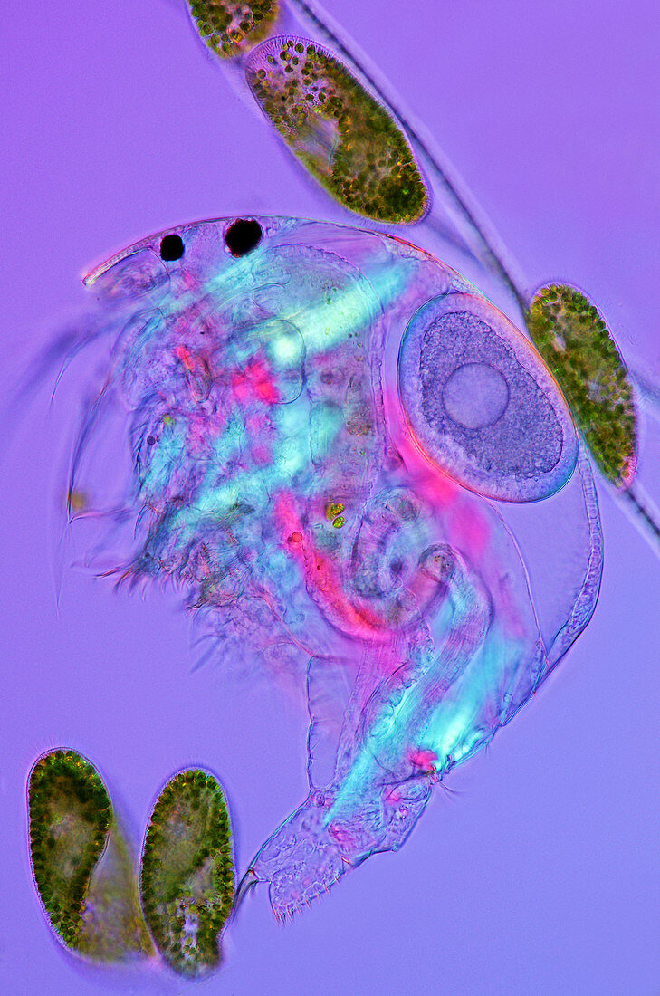Water flea and paramecium,micrograph