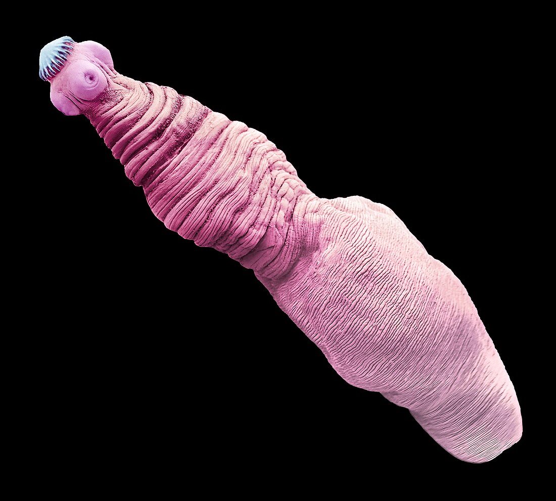 Tapeworm cysticercus,SEM