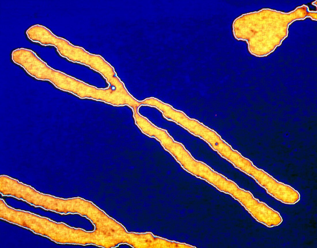 Computer-enhanced LM of human chromosomes