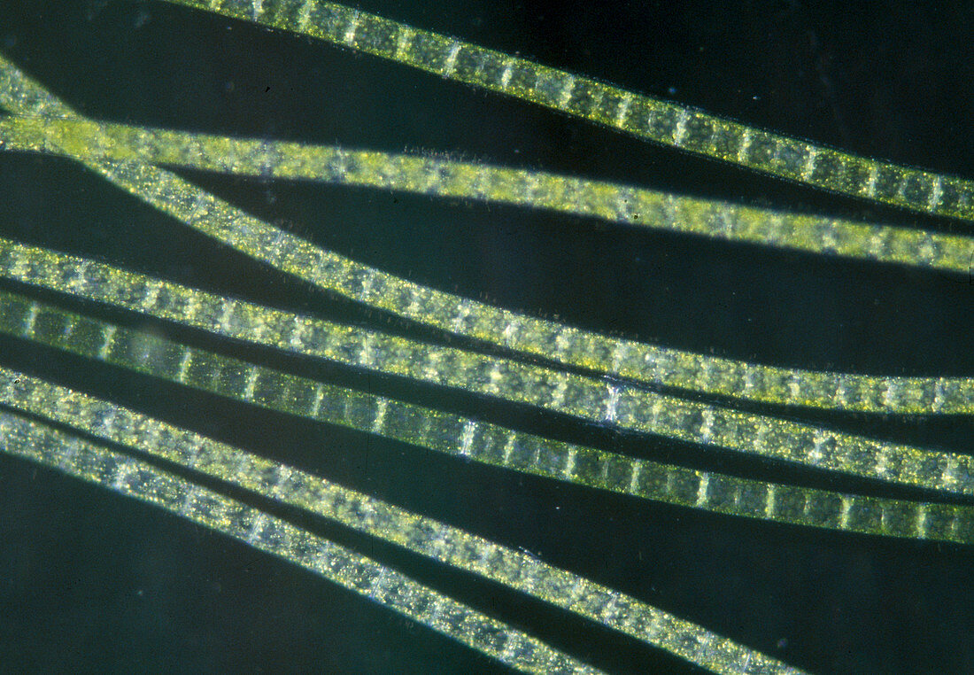 Wothe: Cladophora (filamentous algae)
