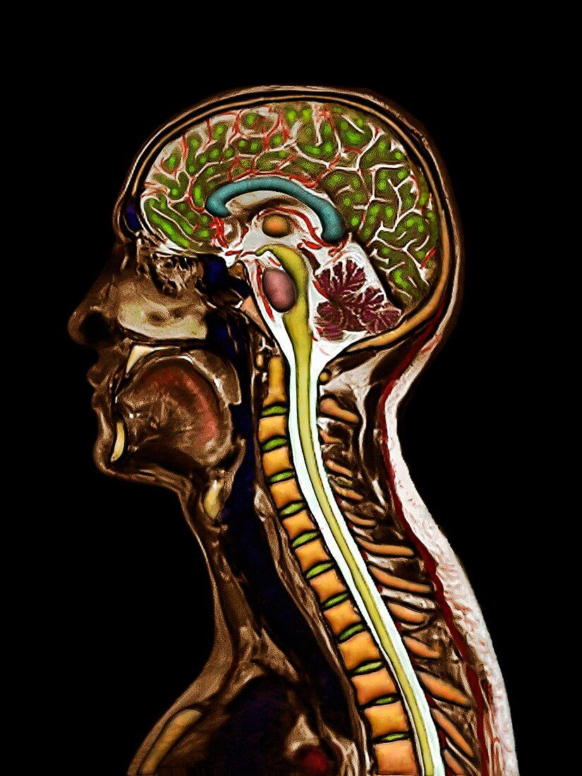 Head and neck, sagittal MRI