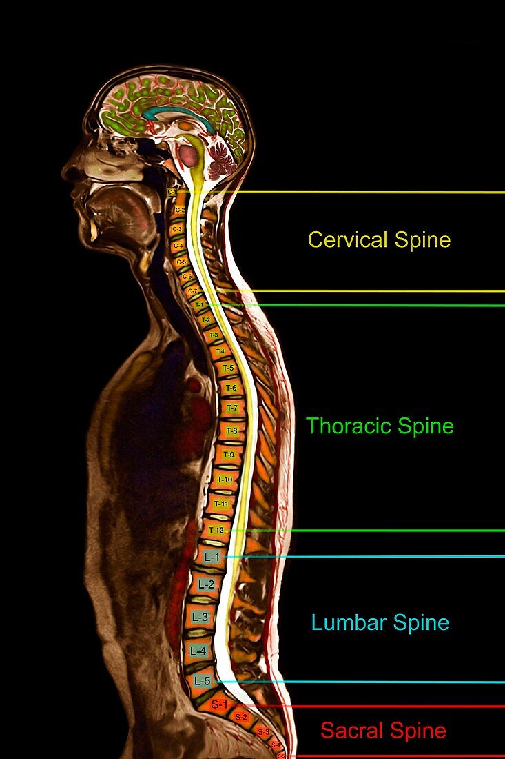 Regions of the spine, sagittal MRI