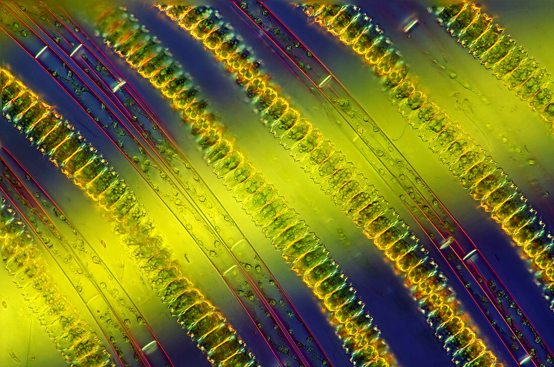 Desmids and Spirogyra algae, micrograph