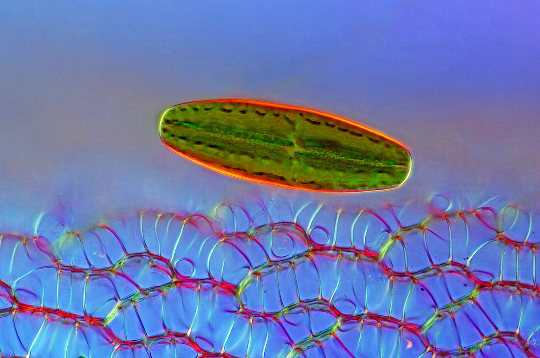 Desmid and sphagnum moss, micrograph