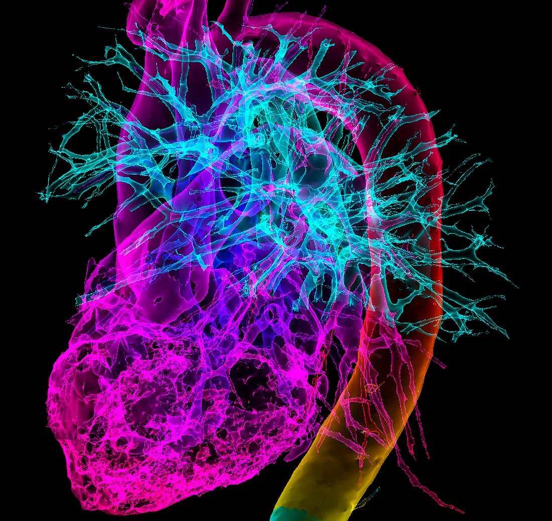 Human heart and great vessels, 3D CT scan
