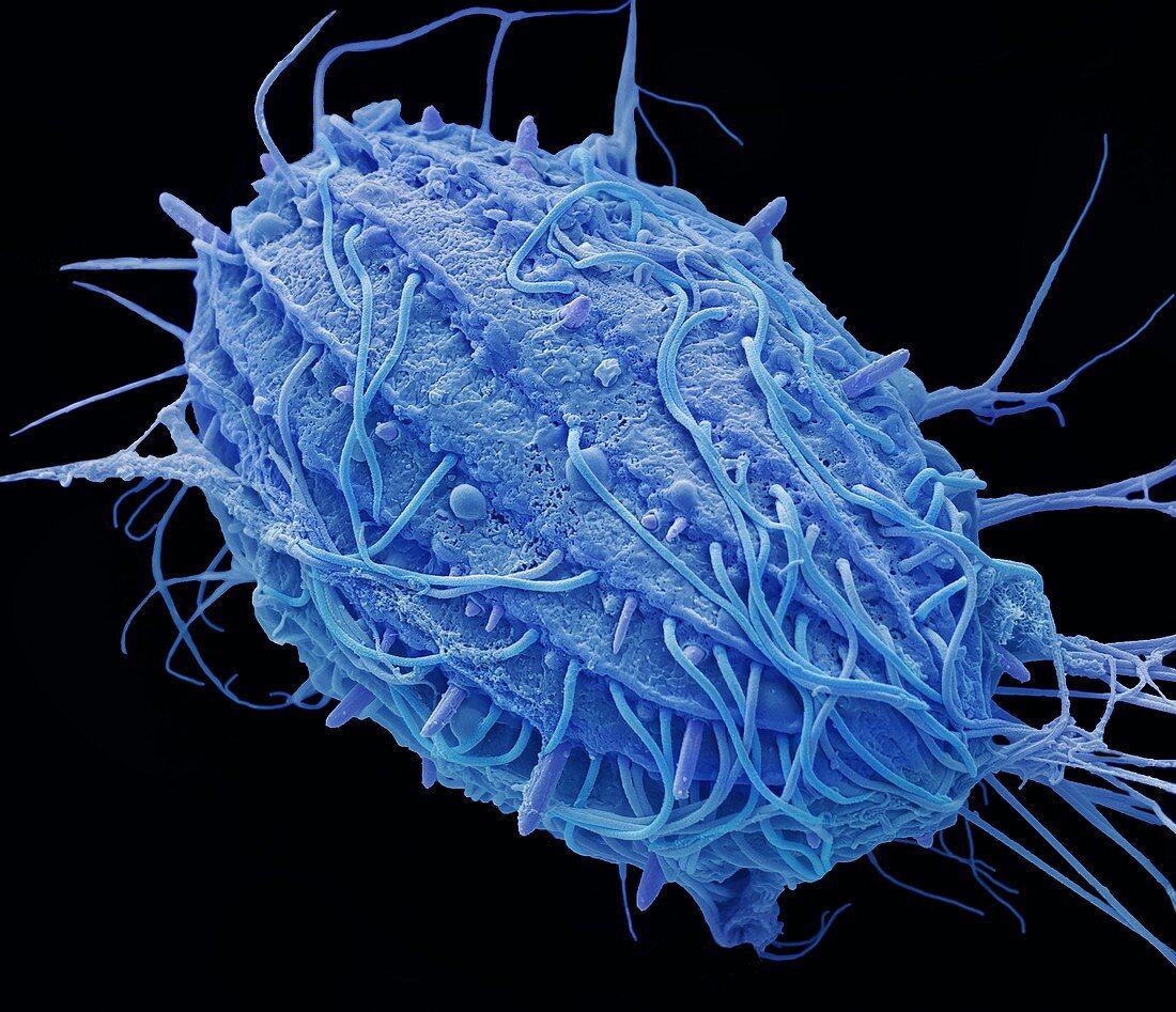 Marine ciliate protozoan, SEM