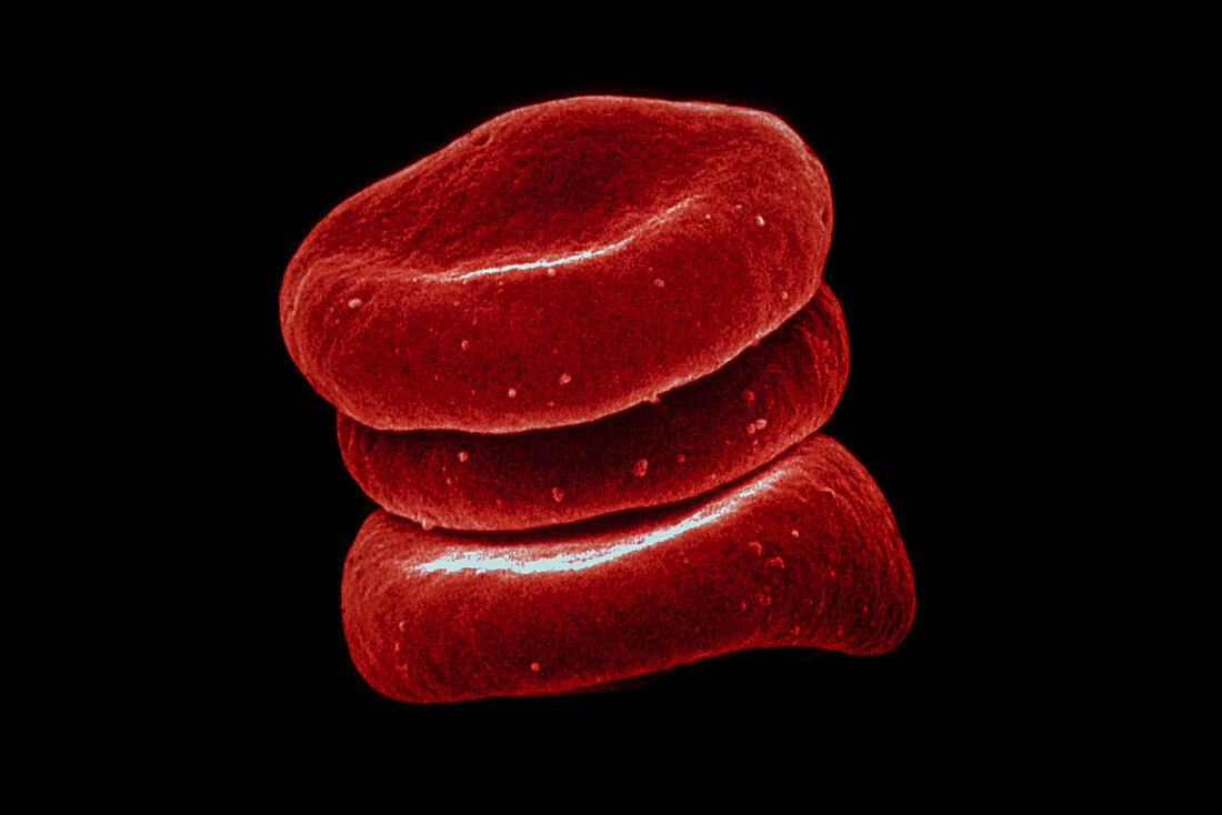 Blood cell, SEM