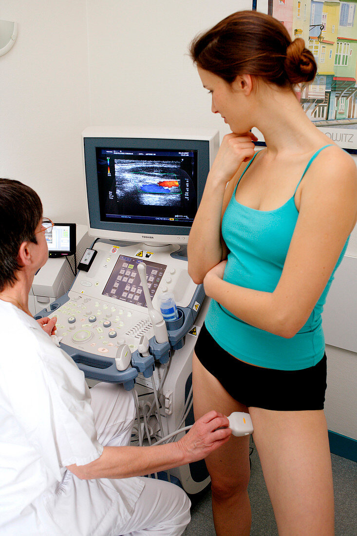 Doppler ultrasound scan