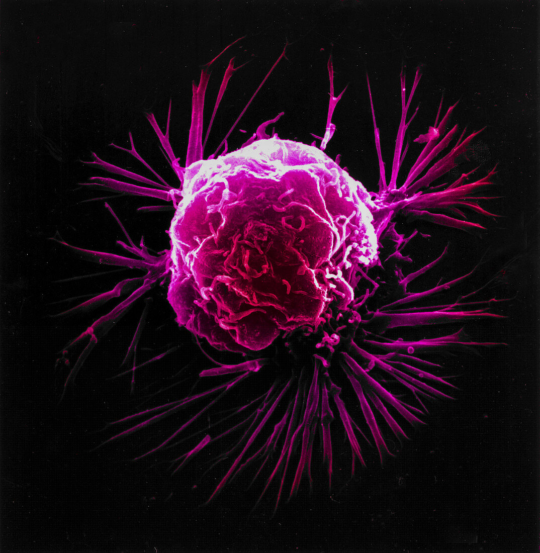 Cancer Cell, SEM