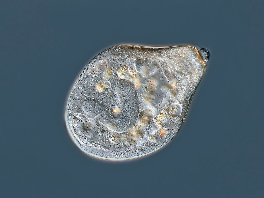 Apocarchesium protozoan macrozoid, light micrograph