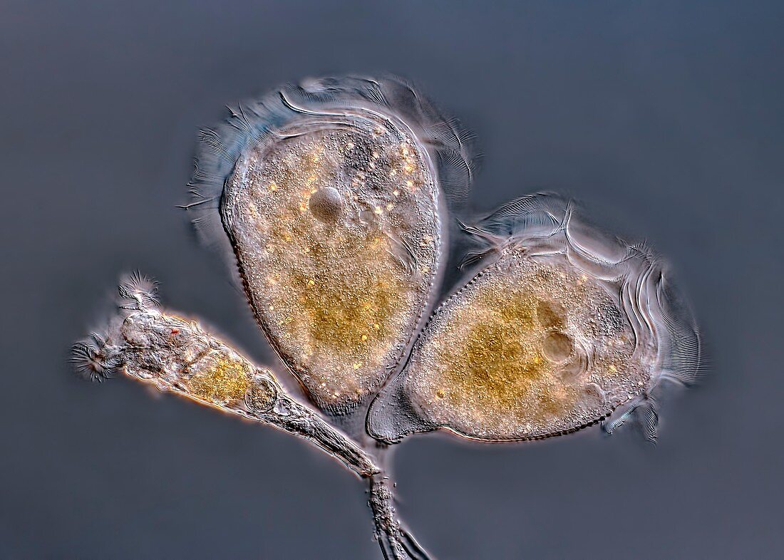 Campanella protozoa, light micrograph