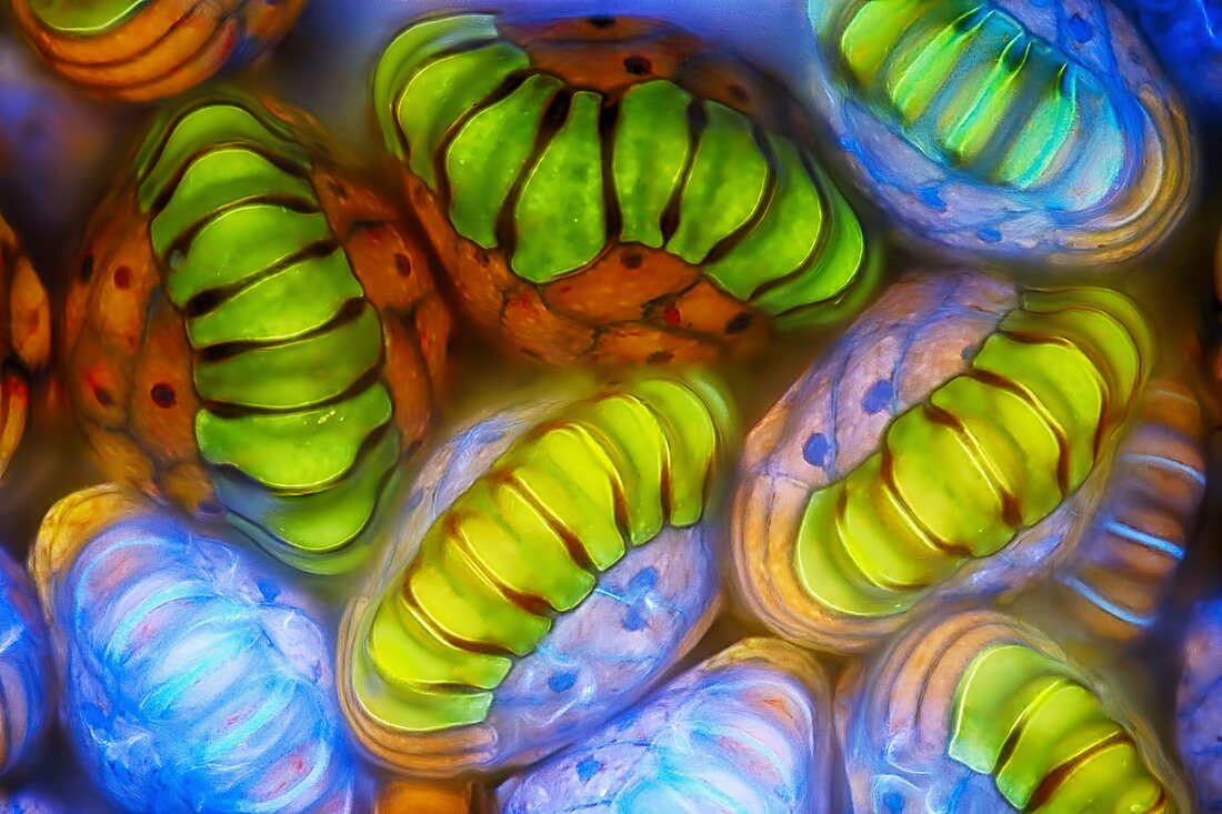Fern sporangia, fluorescence light micrograph