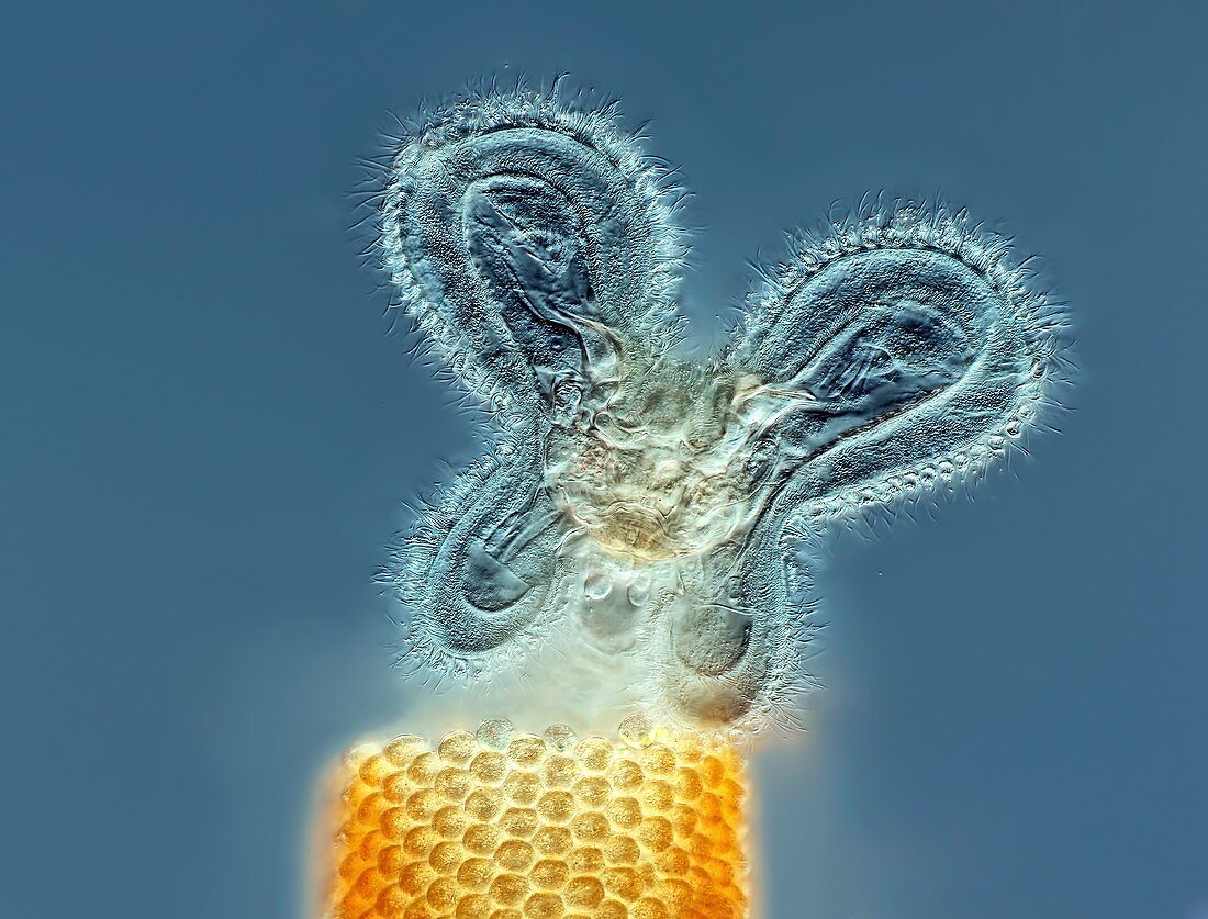 Floscularia sp. rotifer, light micrograph