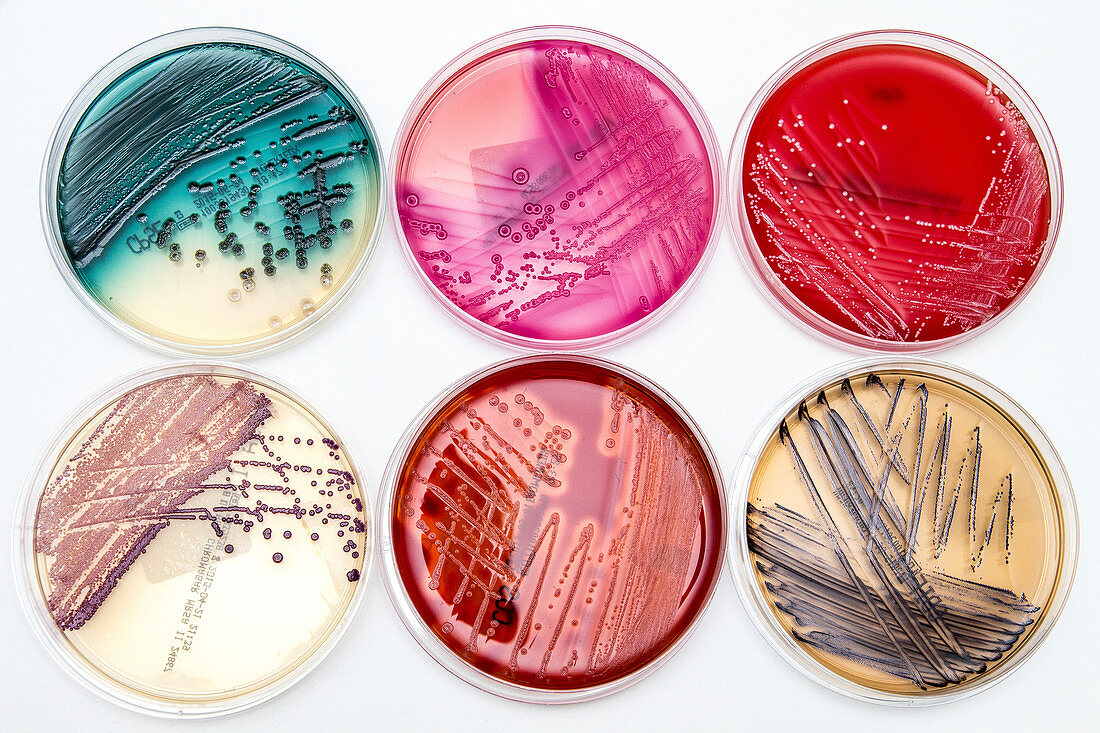 Bacterial growth on culture media