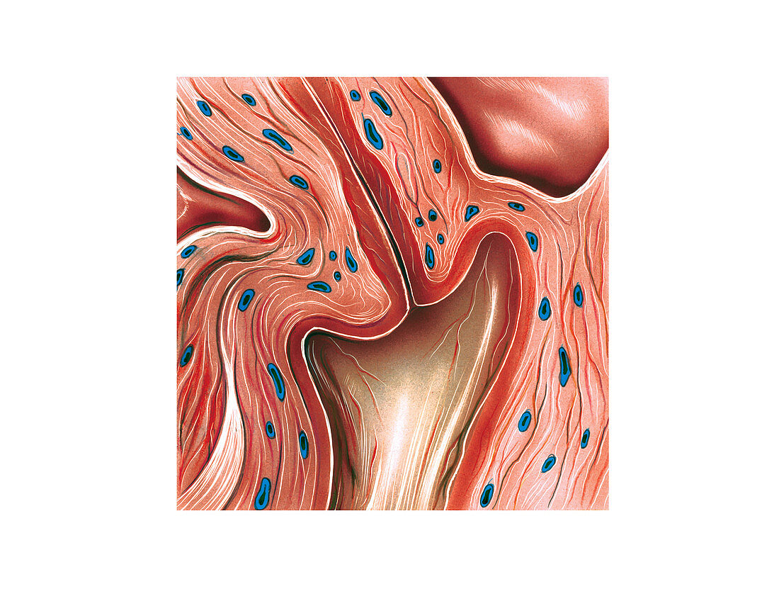 Cervix,illustration