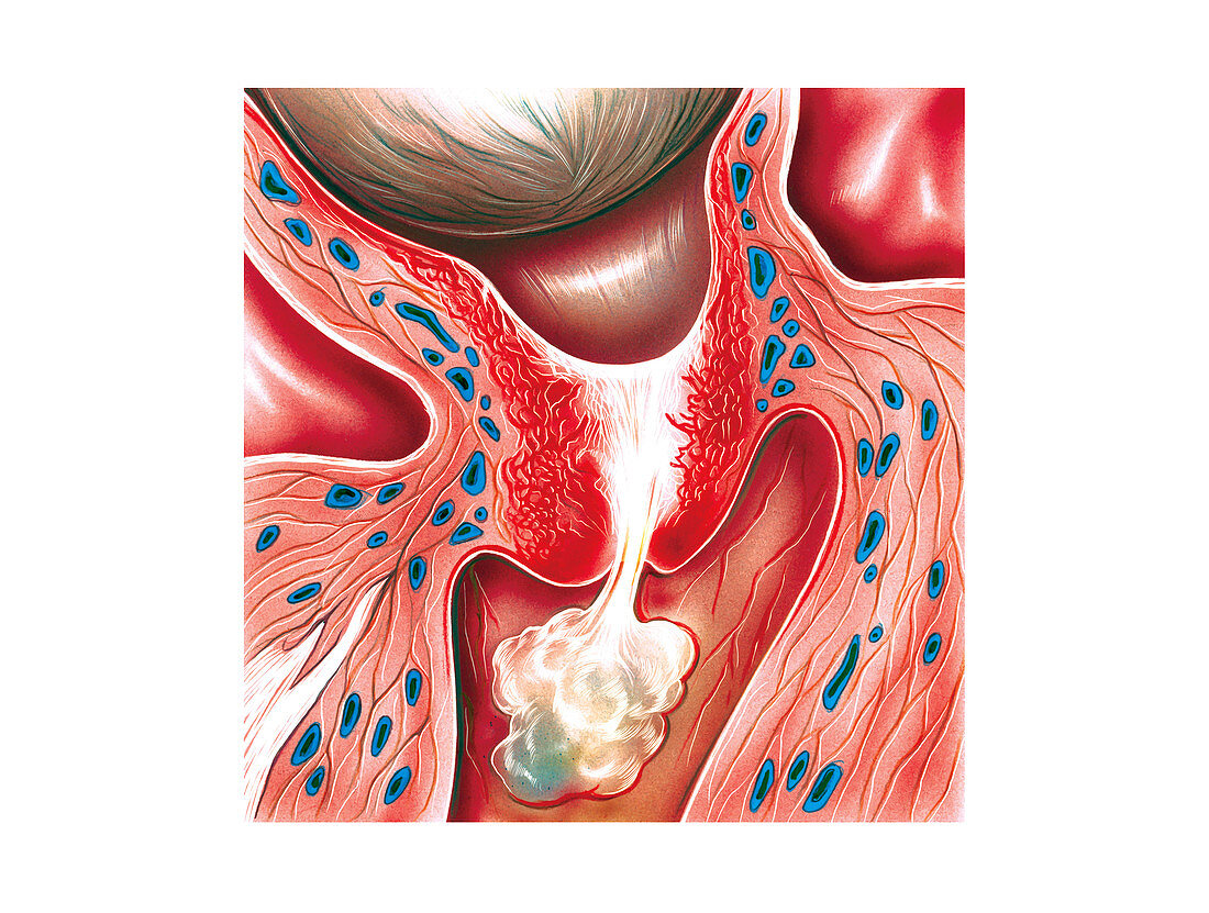 Cervix in pregnancy,illustration