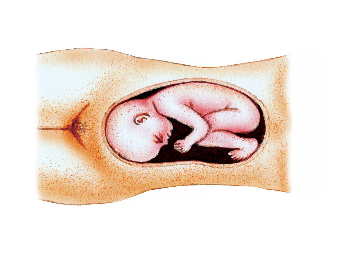 Full term foetus,illustration