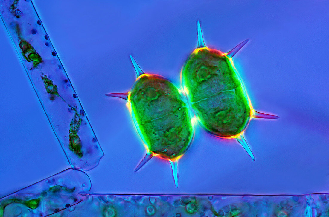 Desmids and green algae,light micrograph