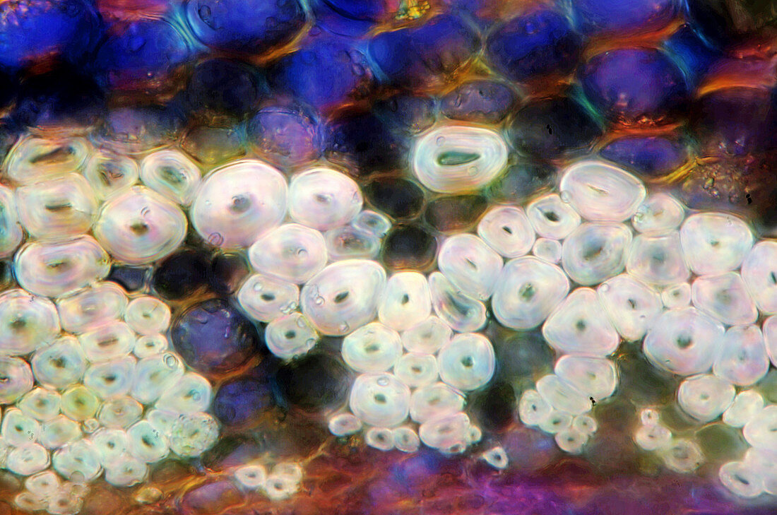 Cherry tree stem,light micrograph